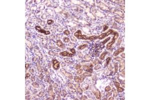IHC testing of FFPE mouse kidney tissue with IGFBP2 antibody at 2ug/ml. (IGFBP2 抗体  (AA 35-304))