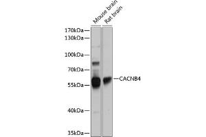 Western Blotting (WB) image for anti-Calcium Channel, Voltage-Dependent, beta 4 Subunit (CACNB4) (AA 401-520) antibody (ABIN6137821)