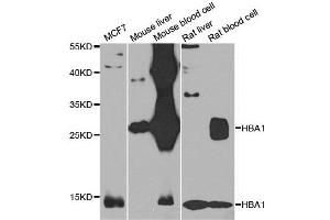 Western blot analysis of extracts of various cell lines, using HBA1 antibody.