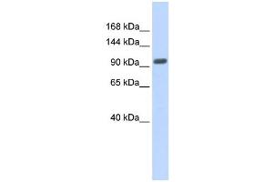 WB Suggested Anti-ZNF512B Antibody Titration: 0. (ZNF512B 抗体  (Middle Region))