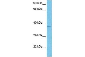 Host:  Rabbit  Target Name:  NOX4  Sample Tissue:  Human 786-0 Whole Cell  Antibody Dilution:  1ug/ml (NADPH Oxidase 4 抗体  (Middle Region))