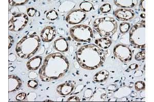 Immunohistochemical staining of paraffin-embedded Human liver tissue using anti-TBXAS1 mouse monoclonal antibody. (TBXAS1 抗体)