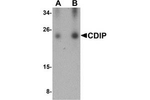 Western Blotting (WB) image for anti-LITAF-Like Protein (CDIP1) (Middle Region) antibody (ABIN1030904) (CDIP1 抗体  (Middle Region))