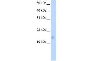 VAMP5 antibody used at 5 ug/ml to detect target protein. (VAMP5 抗体)