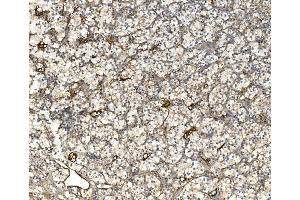 IHC analysis of EIF3C using anti-EIF3C antibody (ABIN7602528).