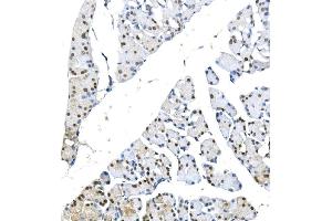 IHC analysis of METTL1 using anti-METTL1 antibody (ABIN7600484). (METTL1 抗体  (AA 2-276))