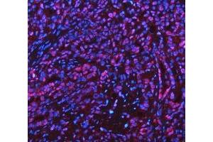 IF analysis of ADK using anti-ADK antibody (ABIN4886430). (ADK 抗体  (AA 165-351))