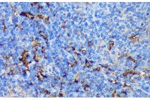 Immunohistochemistry (Paraffin-embedded Sections) (IHC (p)) image for anti-Peptidyl Arginine Deiminase, Type IV (PADI4) antibody (ABIN7258978)