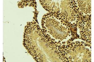 ABIN6276363 at 1/100 staining Mouse testis tissue by IHC-P. (CARD8 抗体)