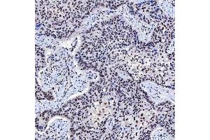 IHC analysis of SNRNP200 using anti-SNRNP200 antibody (ABIN7602032). (SNRNP200 抗体  (AA 557-2129))