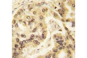 Immunohistochemistry (IHC) image for anti-Tumor Protein P53 (TP53) (AA 293-322) antibody (ABIN3029384)