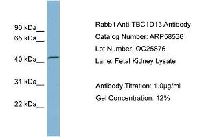 WB Suggested Anti-TBC1D13  Antibody Titration: 0. (TBC1D13 抗体  (Middle Region))