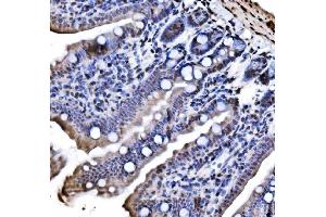 IHC analysis of CBX1/HP1 beta using anti-CBX1/HP1 beta antibody (ABIN7602012).