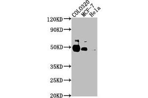 Western Blot Positive WB detected in: COLO320 whole cell lysate, MCF-7 whole cell lysate, Hela whole cell lysate All lanes: KRT20 antibody at 1:2000 Secondary Goat polyclonal to rabbit IgG at 1/50000 dilution Predicted band size: 49 kDa Observed band size: 49 kDa (Keratin 2 抗体  (AA 207-424))