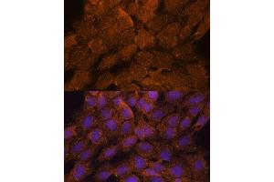 Immunofluorescence analysis of C6 cells using TNFL2 antibody (ABIN6133093, ABIN6149298, ABIN6149299 and ABIN6217788) at dilution of 1:100. (TNFAIP8L2 抗体  (AA 1-184))