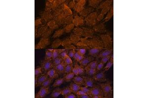 Immunofluorescence (IF) image for anti-Tumor Necrosis Factor, alpha-Induced Protein 8-Like 2 (TNFAIP8L2) (AA 1-184) antibody (ABIN6149298)