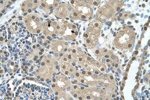 Image no. 1 for anti-Shwachman-Bodian-Diamond Syndrome (SBDS) (AA 51-100) antibody (ABIN205087) (SBDS 抗体  (AA 51-100))
