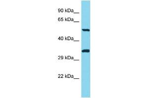 Host: Rabbit Target Name: PNLIPRP3 Sample Type: Jurkat Whole Cell lysates Antibody Dilution: 1. (PNLIPRP3 抗体  (C-Term))