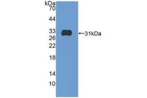 Western blot analysis of recombinant Human ITGb5. (Integrin beta 5 抗体  (AA 137-378))