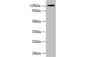 Western blot All lanes: SLC4A8 antibody at 2 μg/mL + Hela whole cell lysate Secondary Goat polyclonal to rabbit IgG at 1/10000 dilution Predicted band size: 123, 121, 118, 112, 78, 84, 72 kDa Observed band size: 123 kDa