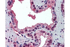 Anti-PABPN1 antibody IHC of human prostate. (PABPN1 抗体  (N-Term))