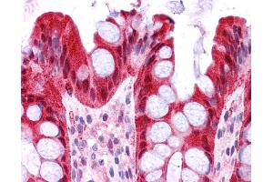 FABP1 antibody was used for immunohistochemistry at a concentration of 4-8 ug/ml. (FABP1 抗体  (N-Term))