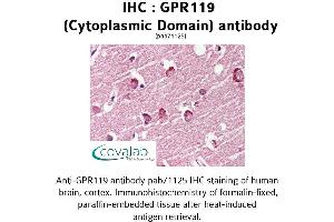 Image no. 1 for anti-G Protein-Coupled Receptor 119 (GPR119) (3rd Cytoplasmic Domain) antibody (ABIN1734912) (G Protein-Coupled Receptor 119 抗体  (3rd Cytoplasmic Domain))