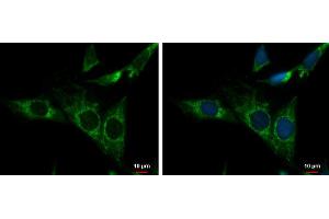 ICC/IF Image NDUFS3 antibody detects NDUFS3 protein at mitochondria by immunofluorescent analysis. (NDUFS3 抗体  (Center))