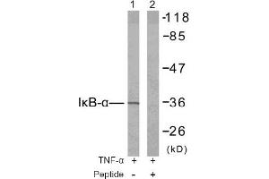 Image no. 2 for anti-Nuclear Factor of kappa Light Polypeptide Gene Enhancer in B-Cells Inhibitor, alpha (NFKBIA) (Tyr42) antibody (ABIN197391) (NFKBIA 抗体  (Tyr42))