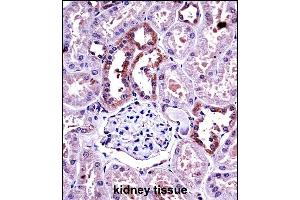 M-CSF Antibody (Center) ((ABIN390719 and ABIN2840996))immunohistochemistry analysis in formalin fixed and paraffin embedded human kidney tissue followed by peroxidase conjugation of the secondary antibody and DAB staining. (M-CSF/CSF1 抗体  (AA 230-257))