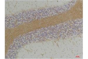 Immunohistochemistry (IHC) analysis of paraffin-embedded Rat Brain Tissue using GABA A Receptor alpha2 Rabbit Polyclonal Antibody diluted at 1:200. (GABRA2 抗体)
