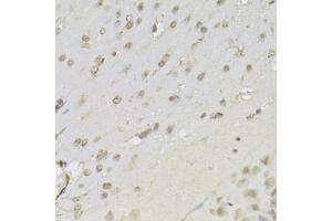 Immunohistochemistry of paraffin-embedded mouse brain using RUNX1 Antibody (ABIN5971086) at dilution of 1/100 (40x lens).