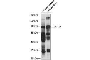 Western blot analysis of extracts of various cell lines, using SSTR2 antibody (ABIN6291365) at 1:1000 dilution. (SSTR2 抗体)