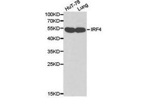 Western Blotting (WB) image for anti-Interferon Regulatory Factor 4 (IRF4) antibody (ABIN1873272)