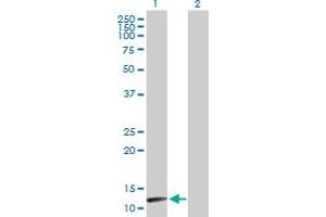 Western Blot analysis of NUDT8 expression in transfected 293T cell line by NUDT8 MaxPab polyclonal antibody.