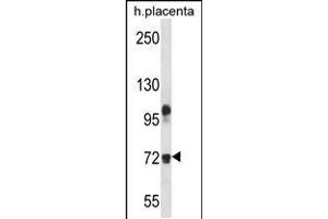 Western blot analysis in human placenta tissue lysates (35ug/lane). (Fibulin 1 抗体  (C-Term))
