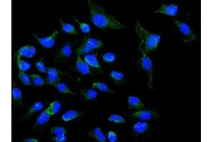 IF analysis of NOX5 using anti-NOX5 antibody (ABIN6719638).