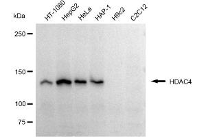 Western blotting analysis using HDAC4 antibody (ABIN7798933).