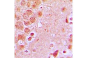 Immunohistochemical analysis of SCC-S2 staining in human brain formalin fixed paraffin embedded tissue section. (TNFAIP8 抗体  (Center))