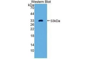 Detection of Recombinant GDF11, Human using Monoclonal Antibody to Growth Differentiation Factor 11 (GDF11) (GDF11 抗体  (AA 138-386))