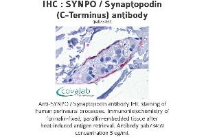 Image no. 1 for anti-Synaptopodin (SYNPO) (C-Term) antibody (ABIN1739830) (SYNPO 抗体  (C-Term))