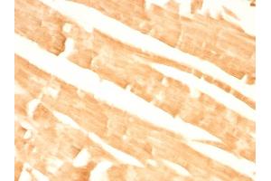 Immunohistochemistry (IHC) image for anti-Glypican 3 (GPC3) antibody (ABIN6939525)