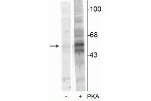 Western blot of recombinant tryptophan hydroxylase incubated in the absence (-) and presence (+) of cAMP-dependent protein kinase  showing specific immunolabeling of the ~55 kDa tryptophan hydroxylase protein phosphorylated at Ser58. (Tryptophan Hydroxylase 1 抗体  (pSer58))