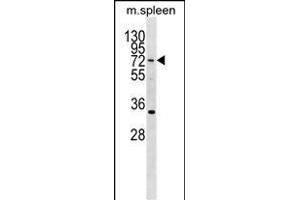 HIC2 Antibody (Center) (ABIN1538292 and ABIN2850037) western blot analysis in mouse spleen tissue lysates (35 μg/lane). (HIC2 抗体  (AA 311-338))