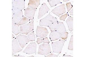Immunohistochemistry (Paraffin-embedded Sections) (IHC (p)) image for anti-Cyclic Nucleotide Gated Channel alpha 1 (CNGA1) antibody (ABIN7073608)