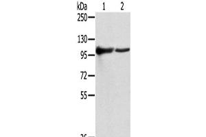 Western Blot analysis of K562 and A431 cells using TPX2 Polyclonal Antibody at dilution of 1/800 (TPX2 抗体)