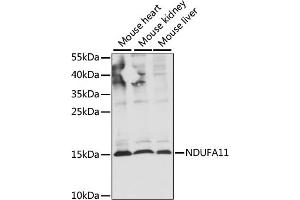 Western blot analysis of extracts of various cell lines, using NDUF antibody (ABIN7268798) at 1:1000 dilution. (NDUFA11 抗体  (AA 1-100))