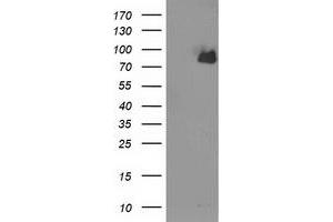 Western Blotting (WB) image for anti-Acyl-CoA Synthetase Short-Chain Family Member 2 (ACSS2) antibody (ABIN1496431) (ACSS2 抗体)