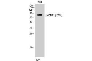 Western Blotting (WB) image for anti-P21-Activated Kinase 1 (PAK1) (pSer204) antibody (ABIN3173316) (PAK1 抗体  (pSer204))