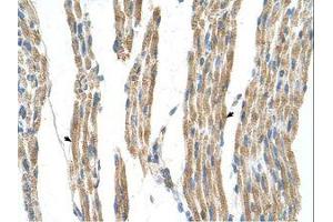 Image no. 1 for anti-Alanine Aminotransferase (ALT) (AA 31-80) antibody (ABIN320978) (ALT 抗体  (AA 31-80))